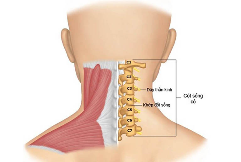 Thoái hoá đốt sống cổ